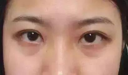 最新車禍?zhǔn)录l(fā)反思，悲劇背后的警醒與啟示