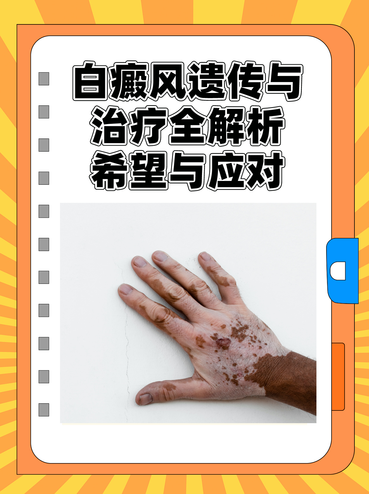 白癜風(fēng)最新治療技術(shù)，重塑自信，笑迎人生挑戰(zhàn)